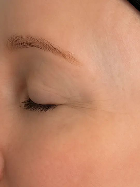 Before treatment