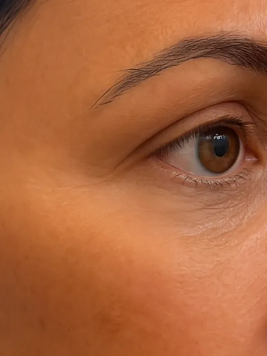 Before treatment
