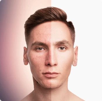 SKIN & FACE treatment at Toronto medical spa - Every treatment—whether it's collagen stimulation,...