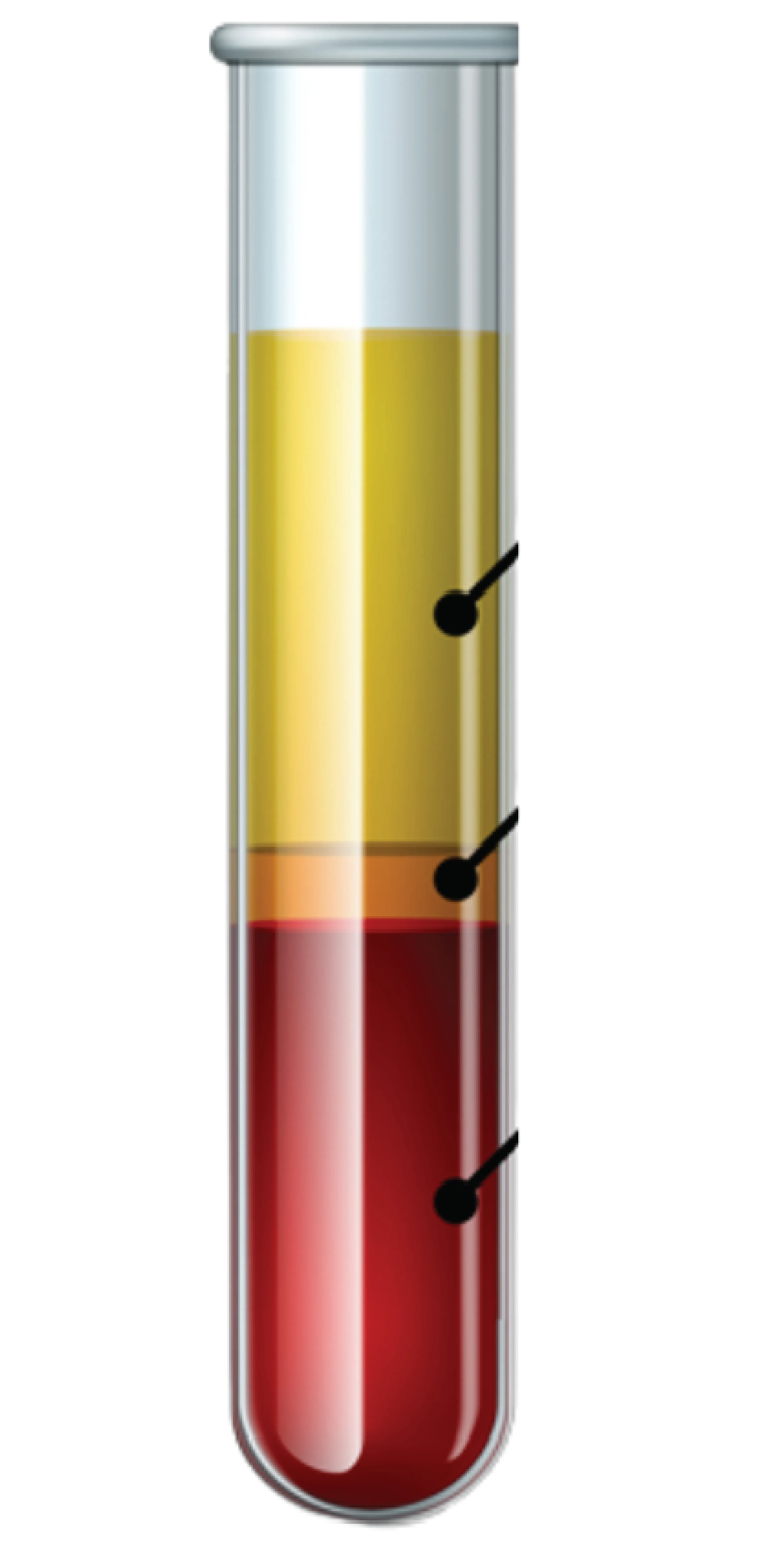 O-Shot (Orgasmic Shot) treatment machine at Toronto medical spa - oshot
