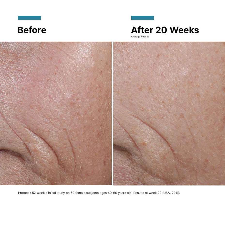 C E Ferulic thumbnail 12