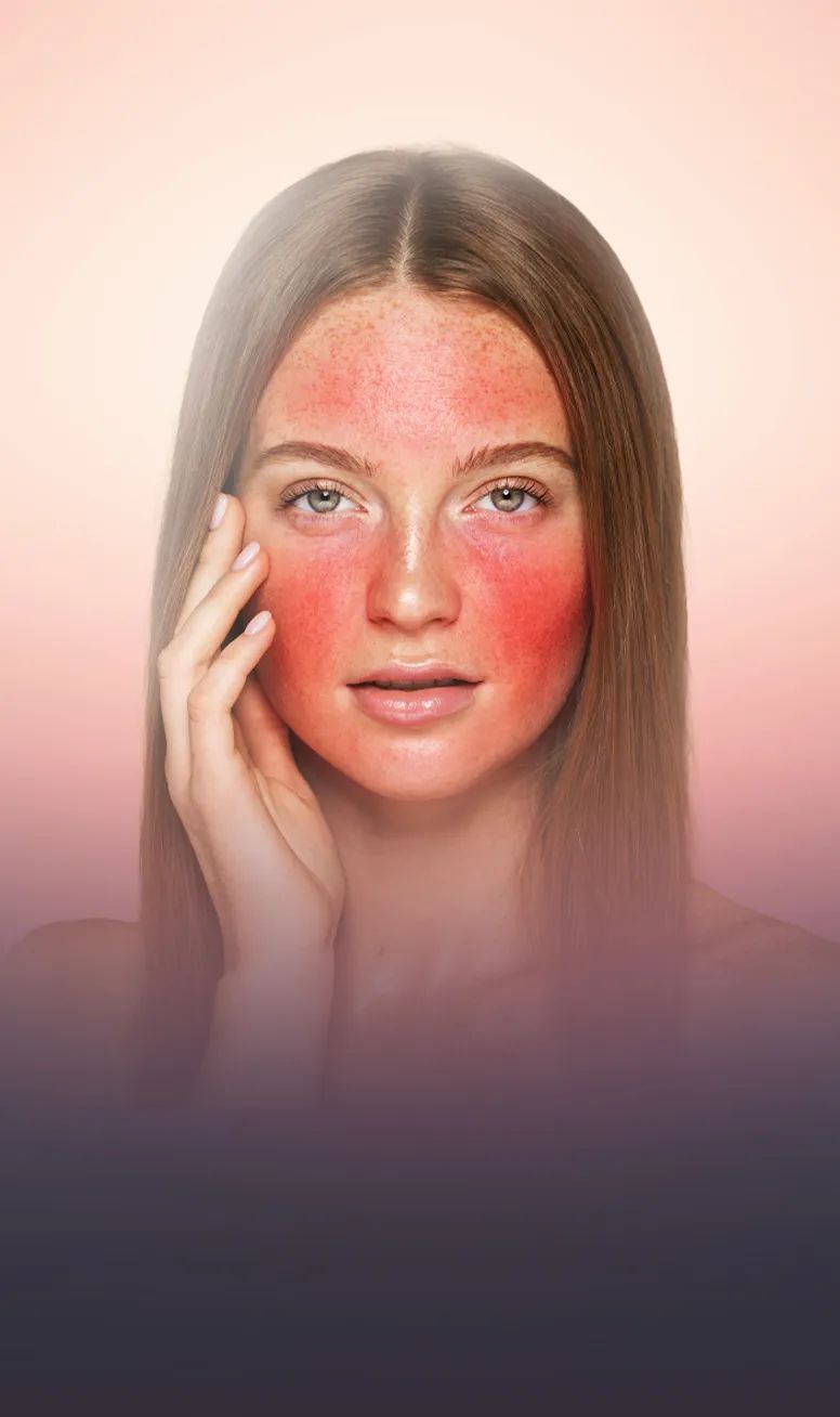 PRP Facial Rejuvenation treatment at Toronto medical spa - PRP stimulates collagen repair and elasticity. Tre...