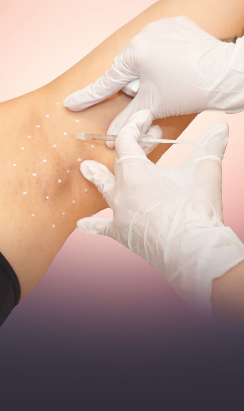 Hyperhidrosis Treatment (Underarm Sweating) treatment at Toronto medical spa - Botox blocks nerve signals to reduce sweating and ...