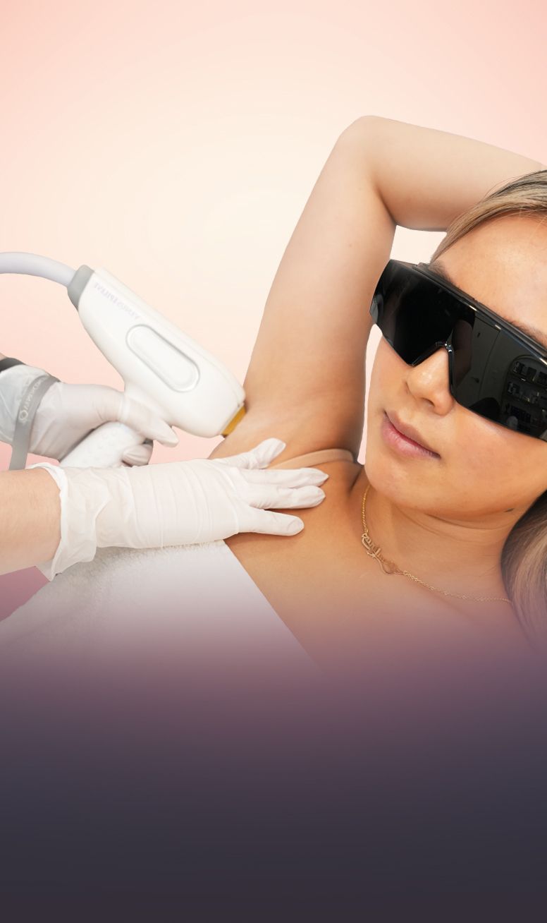 Laser Hair Removal treatment at Toronto medical spa - Epileve laser removes hair gently and permanently—...