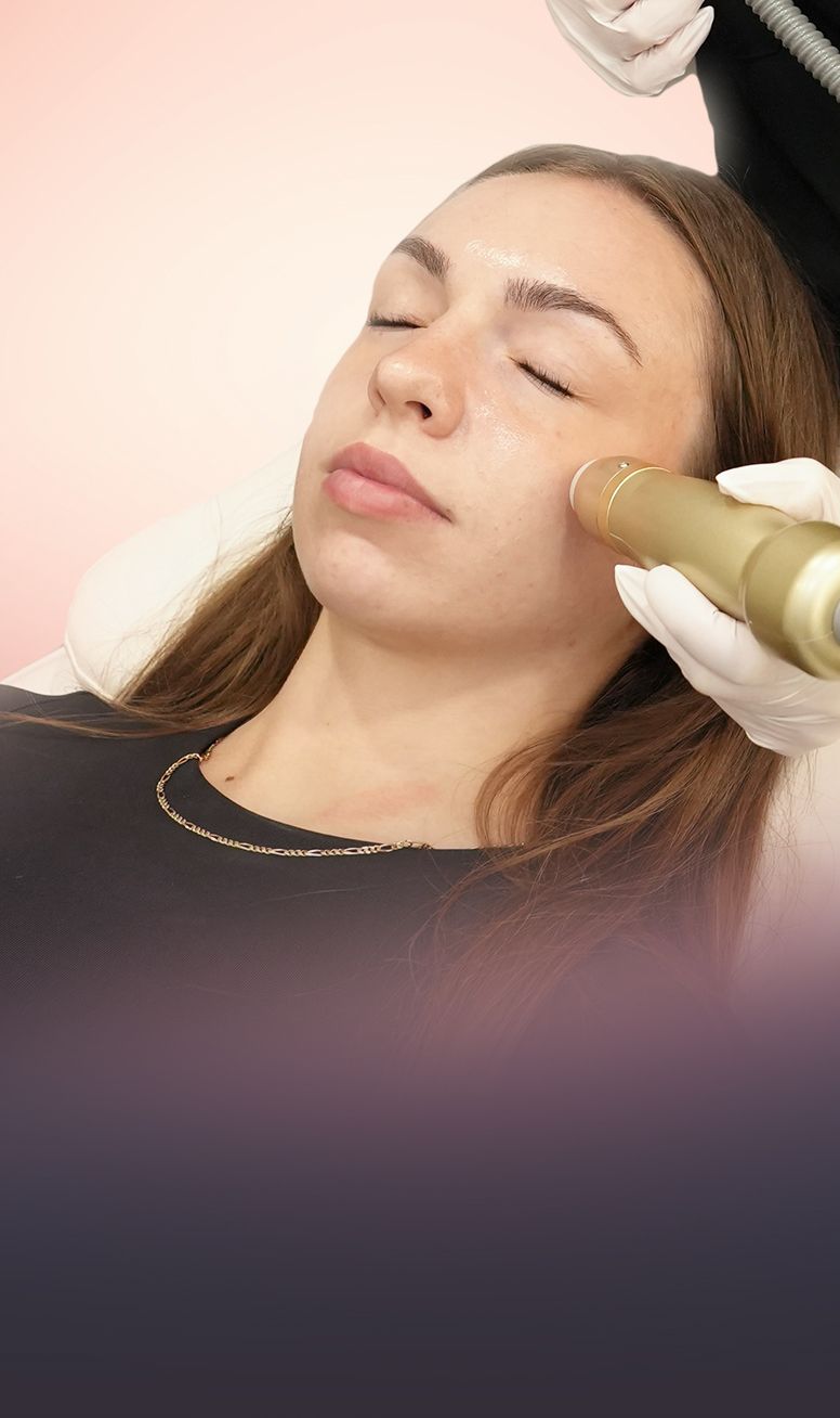 Sylfirm X Radiofrequency Microneedling (Face) treatment at Toronto medical spa - Sylfirm X treats pigment and rosacea—only RF safe ...