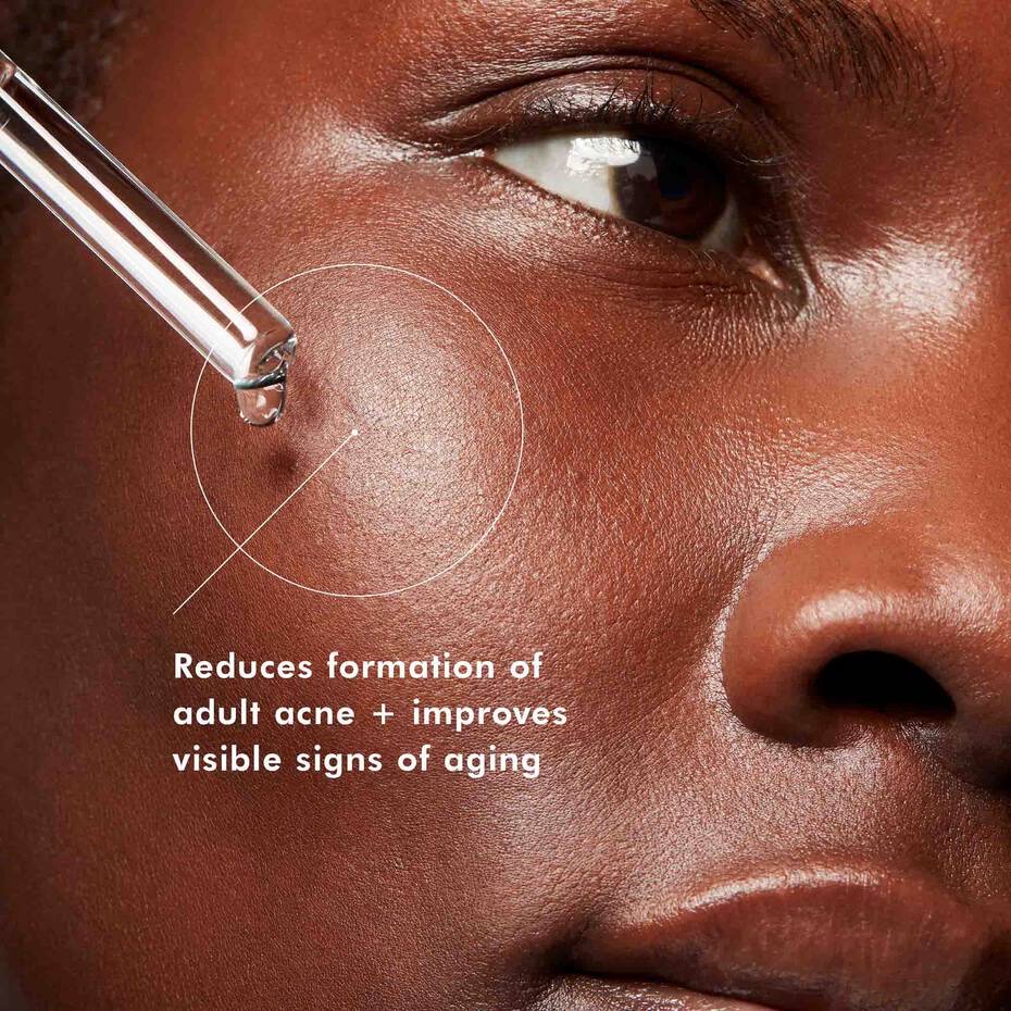 Blemish and Age Defense 15ml thumbnail 6