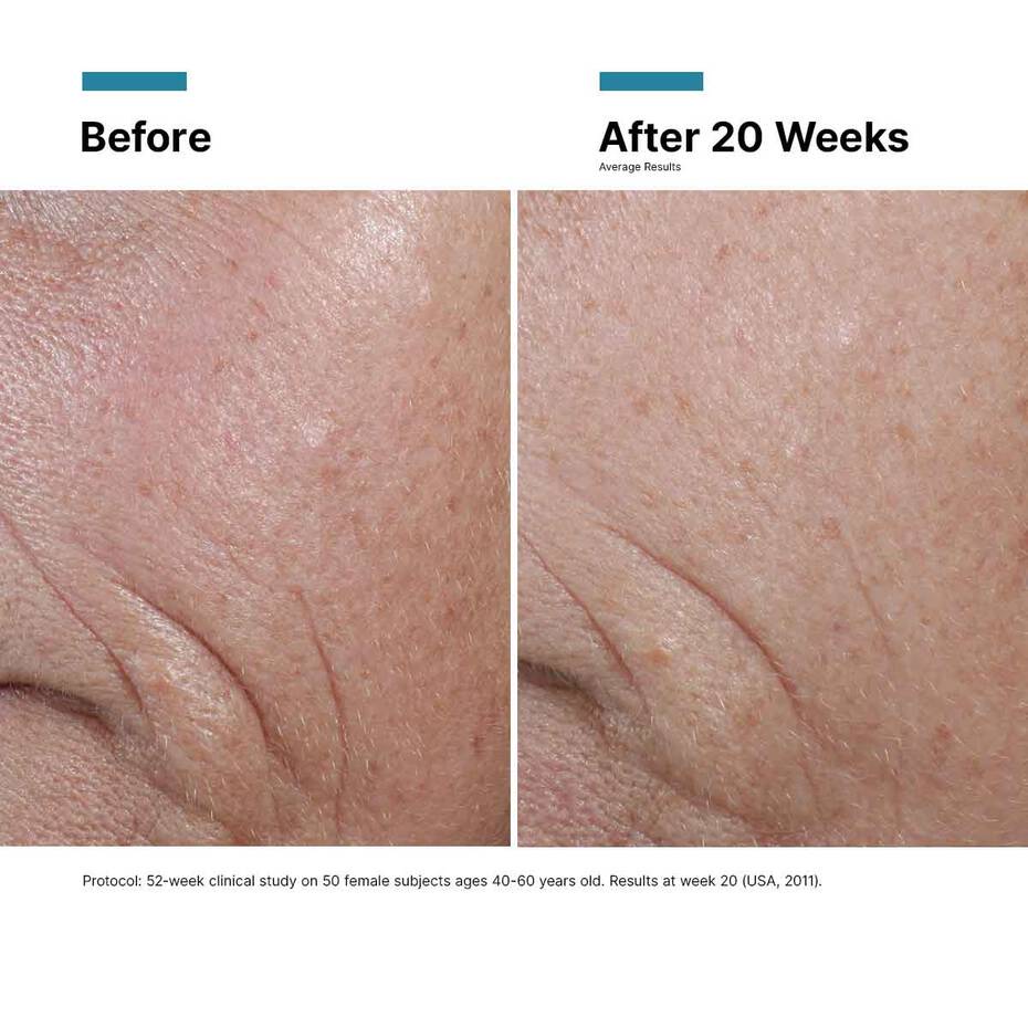 C E Ferulic thumbnail 12