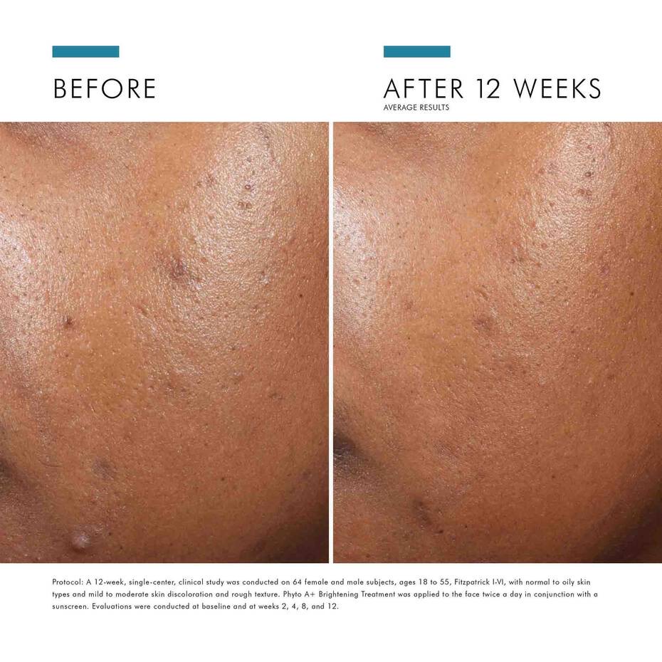 Phyto A+ Brightening Treatment thumbnail 3