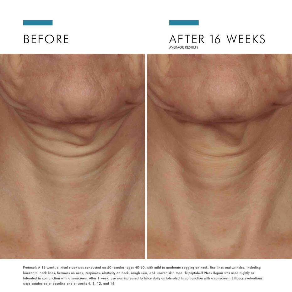Tripeptide-R Neck Repair thumbnail 7