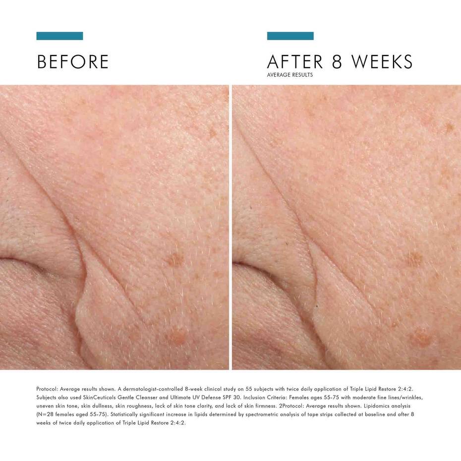 Triple Lipid Restore 48ml thumbnail 11